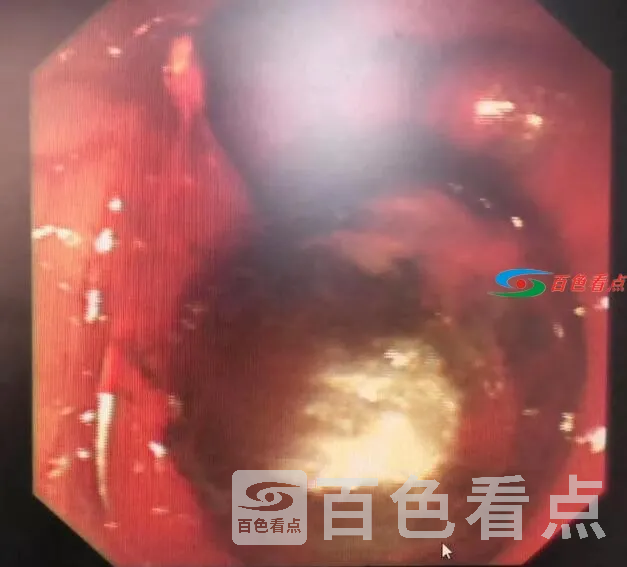 QQ截图20210305142701.webp