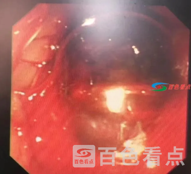 QQ截图20210305142655.webp