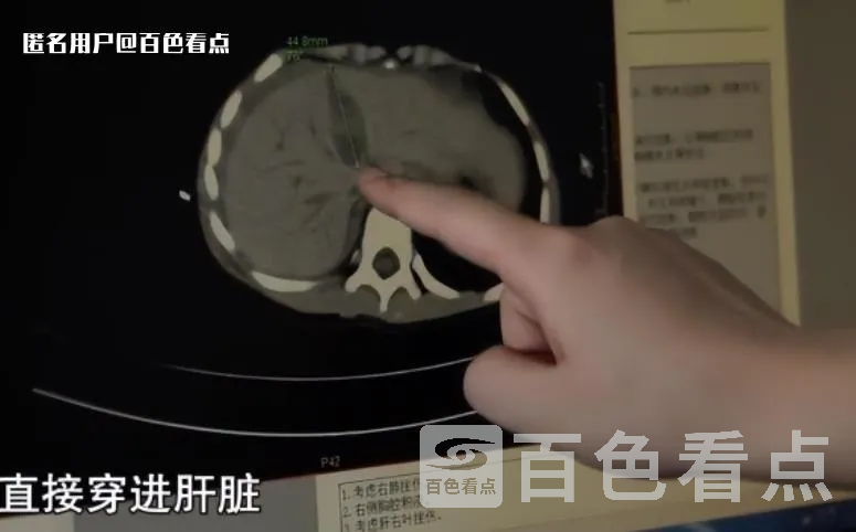 微信截图_20230623091749.webp